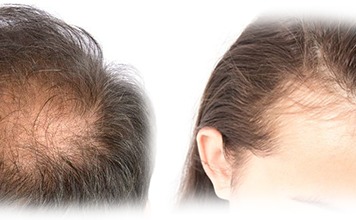 Hair Problem