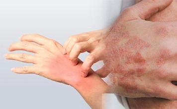Skin Problem